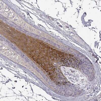 Immunohistochemistry-Paraffin: DAPL1 Antibody [NBP2-14582]