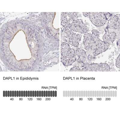 Immunohistochemistry-Paraffin: DAPL1 Antibody [NBP2-14582]