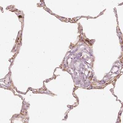 Immunohistochemistry: DAPP1 Antibody [NBP2-33452]