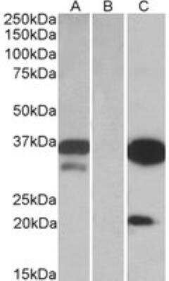 Western Blot: DAPP1 Antibody [NBP2-27542]