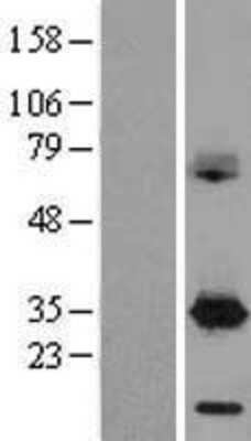 Western Blot: DAPP1 Overexpression Lysate [NBL1-09718]