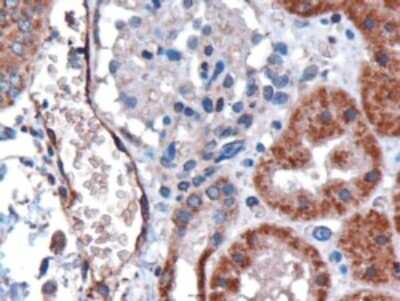 Immunohistochemistry-Paraffin: DARC Antibody [NB100-2421]