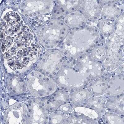 Immunohistochemistry-Paraffin: DARC Antibody [NBP1-86586]