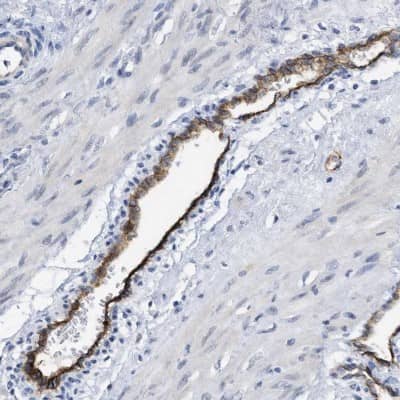 Immunohistochemistry-Paraffin: DARC Antibody [NBP1-86586]