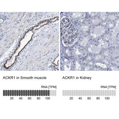 Immunohistochemistry-Paraffin: DARC Antibody [NBP1-86586]