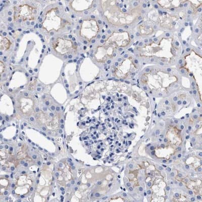 Immunohistochemistry-Paraffin: DARC Antibody [NBP1-86587]
