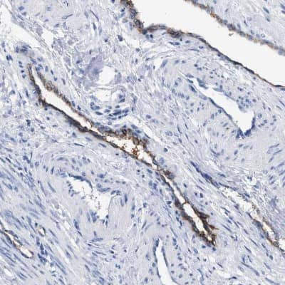 Immunohistochemistry-Paraffin: DARC Antibody [NBP1-86587]