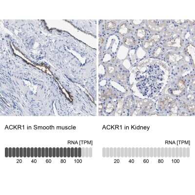 Immunohistochemistry-Paraffin: DARC Antibody [NBP1-86587]