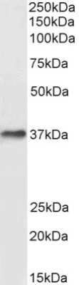 Western Blot: DARC Antibody [NB100-2421]