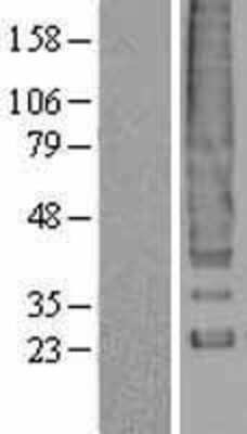 Western Blot: DARC Overexpression Lysate [NBP2-04213]