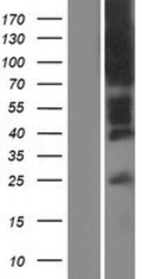 Western Blot: DARC Overexpression Lysate [NBP2-09412]