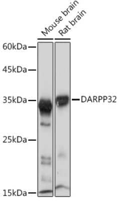 Western Blot: DARPP-32 Antibody (5T9G4) [NBP3-16316]