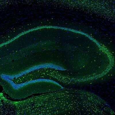 Immunohistochemistry: DARPP-32 Antibody [NBP2-33534]
