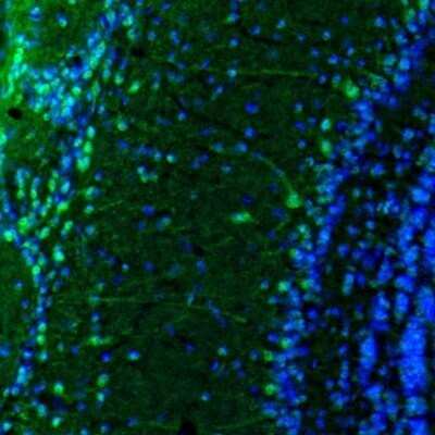 Immunohistochemistry: DARPP-32 Antibody [NBP2-33534]