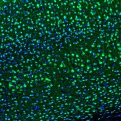 Immunohistochemistry: DARPP-32 Antibody [NBP2-33534]