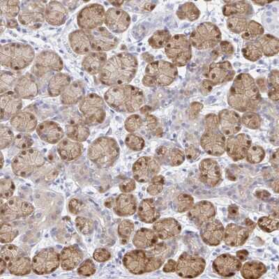 Immunohistochemistry: DARPP-32 Antibody [NBP2-38908]