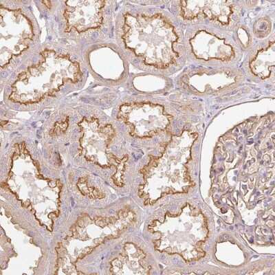 Immunohistochemistry-Paraffin: DARPP-32 Antibody [NBP2-33534]