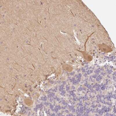 Immunohistochemistry-Paraffin: DARPP-32 Antibody [NBP2-33534]