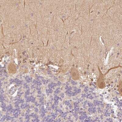 Immunohistochemistry-Paraffin: DARPP-32 Antibody [NBP2-33534]