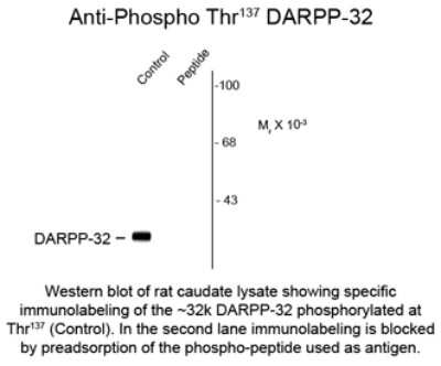 Western Blot: DARPP-32 [p Ser137] Antibody [NBP2-29514]