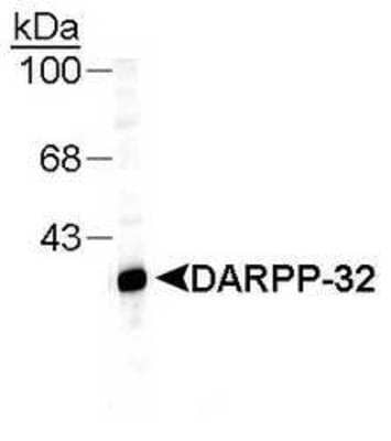 Western Blot: DARPP-32 Antibody [NB300-304]