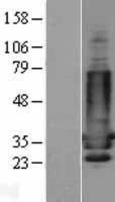 Western Blot: DARPP-32 Overexpression Lysate [NBL1-14679]