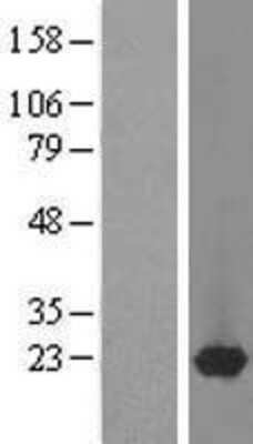 Western Blot: DARPP-32 Overexpression Lysate [NBL1-14680]