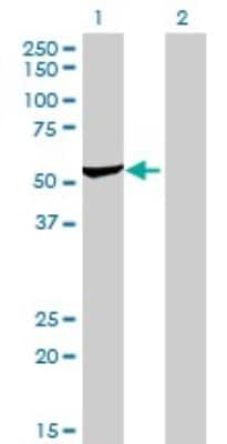 Western Blot: DARS Antibody (2F11) [H00001615-M01]