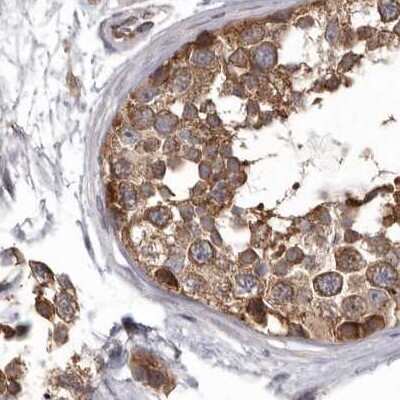 Immunohistochemistry-Paraffin: DARS Antibody [NBP1-85937]