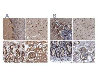 Immunohistochemistry-Paraffin: DARS Antibody [NBP1-85938]