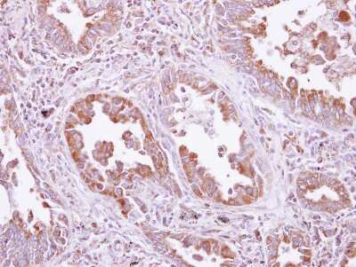 Immunohistochemistry-Paraffin: DARS Antibody [NBP2-16101]