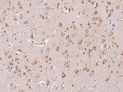 Immunohistochemistry-Paraffin: DARS Antibody [NBP3-00268]