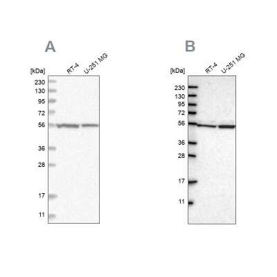 Western Blot: DARS Antibody [NBP1-85938]