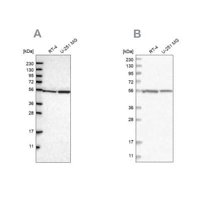 Western Blot: DARS Antibody [NBP1-86027]