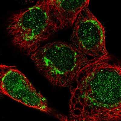 Immunocytochemistry/ Immunofluorescence: DARS2 Antibody [NBP1-83854]