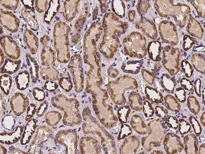 Immunohistochemistry: DARS2 Antibody [NBP2-97255]