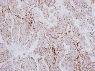 Immunohistochemistry-Paraffin: DARS2 Antibody [NBP2-16102]