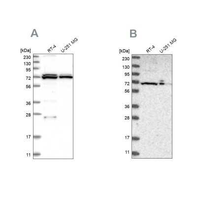 Western Blot: DARS2 Antibody [NBP1-83854]