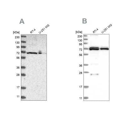 Western Blot: DARS2 Antibody [NBP1-83855]