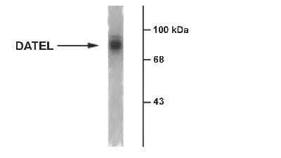 Western Blot: SLC6A3/DAT1 Antibody [NB300-255]