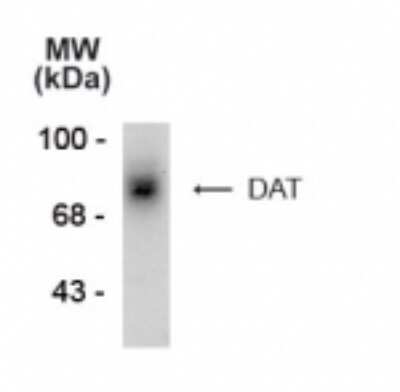 Western Blot: SLC6A3/DAT1 Antibody [NB300-255]