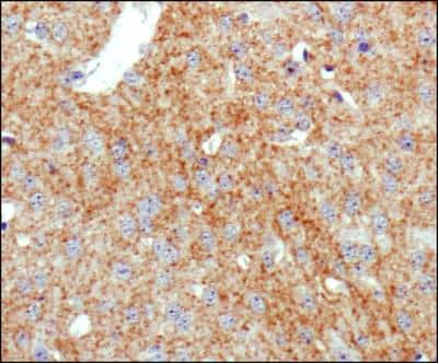 Immunohistochemistry-Paraffin: SLC6A3/DAT1 Antibody (mAb16) [NBP2-22164]