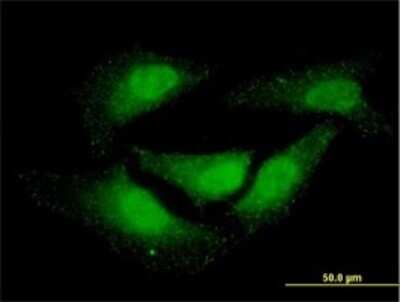 Immunocytochemistry/ Immunofluorescence: DAX1/NR0B1 Antibody (2F12) [H00000190-M02]