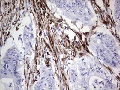 Immunohistochemistry: DAX1/NR0B1 Antibody (OTI5F5) [NBP2-46212]