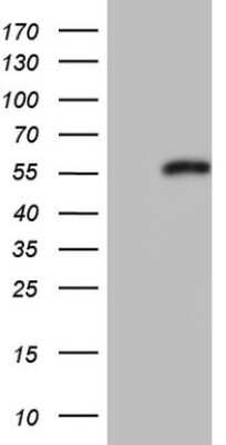 Western Blot: DAX1/NR0B1 Antibody (OTI5F5) [NBP2-46212]