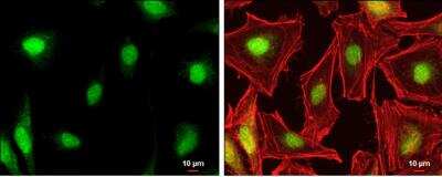 Immunocytochemistry/ Immunofluorescence: DAX1/NR0B1 Antibody [NBP1-32832]