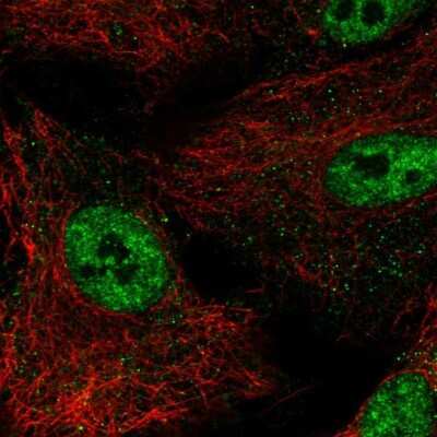 Immunocytochemistry/ Immunofluorescence: DAX1/NR0B1 Antibody [NBP2-68781]