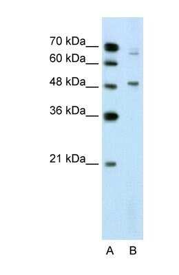 Western Blot: DAX1/NR0B1 Antibody [NBP1-52822]