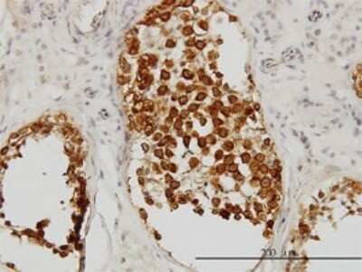 Immunohistochemistry-Paraffin: DAZ1 Antibody (3A4) [H00001617-M09]