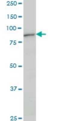 Western Blot: DAZ1 Antibody (3A4) [H00001617-M09]